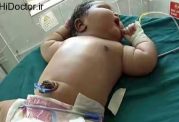 چاق ترین نوزاد دنیا
