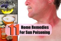 درمان های مختلف برای رفع مسمومیت با نور خورشید
