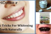 توصیه هایی برای سفید کردن دندان