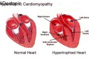 پیشگیری از عارضه های قلبی در افراد ورزشکار