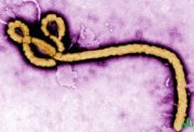 ابولا همچنان تهدید کننده ی سلامت جهان است