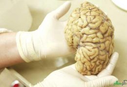 مطالعات جدید درمورد مراکز احساسات در مغز