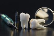 مراقبت از دندان ها قبل از جراحی