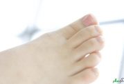 اختلالات مرتبط با کف پا