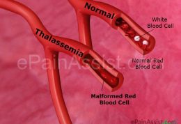 دانستنی های مفید برای مبتلایان به تالاسمی