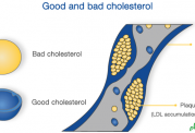 تشخیص کلسترول خوب از بد و تاثیرات آن ها روی بدن