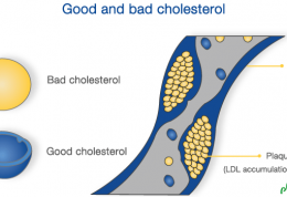 تشخیص کلسترول خوب از بد و تاثیرات آن ها روی بدن