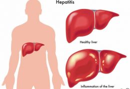 چقدر نسبت به هپاتیت آگاهی دارید؟