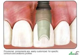 وظیفه یک دندانپزشک در برابر انجام ایمپلنت