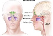 آیا علائم تومور بینی و سینوس را میدانید؟