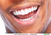 عکس سلفی و تاثیر آن بر دهان و دندان