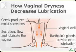 راهکارهای درمانی مناسب برای نرم شدن واژن