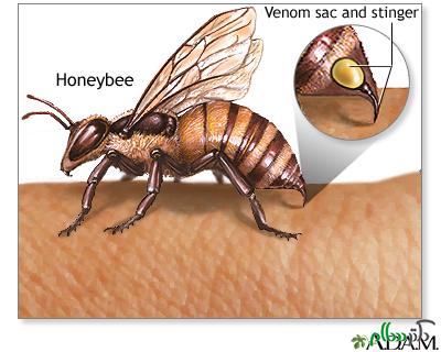 خطرات نیش زنبور عسل برای سلامتی