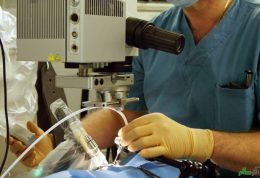 استفاده از دست مکانیکی برای جراحی بینایی