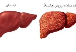 خطر ابتلا به هپاتیت B در نوزادان