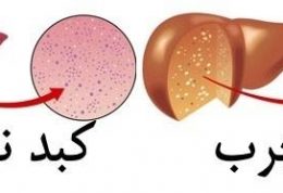 با این ویتامین ها از مبتلا شدن به کبد چرب پیشگیری کنید