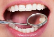 از وجود میلیون ها دندان در دهان تان خبر دارید؟