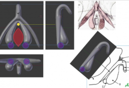 ساخت کلیتوریس سه بعدی