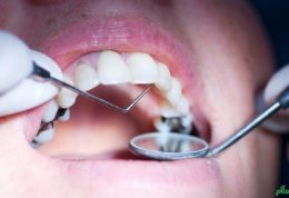 انتقال بیماری های خطرناک از طریق دندانپزشکی