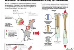 یافته های پزشکی جدید در زمینه مشکلات نخاعی