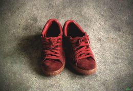 بیماری های ناشی از وارد شدن به خانه با کفش