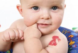 بررسی علمی انواع لکه های روی پوست پس از تولد