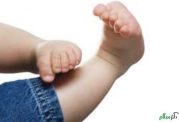 درمان مشکل های ارتوپدی نوزادان زیر 1 ماه بصورت کامل