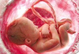 آیا میتوان با صدای قلب جنسیت جنین را تشخیص داد؟