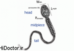 ناهنجاری “اسپرم سر گرد” در ایران