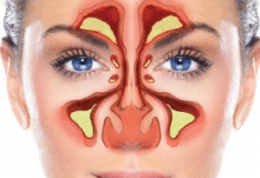 روش های خانگی برای درمان انواع دردهای سینوسی