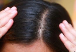 درمان های مختلف برای موی نازک