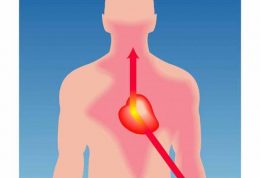 کم شدن درد آنژِین صدری با روش های علمی جدید