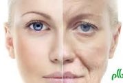 5 نکته ضد پیری پوست از زبان متخصص پوست