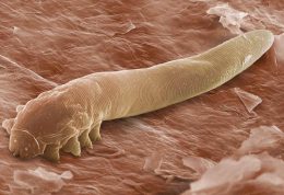 جانوران میکروسکوپی زنده وحشتناک روی پوست