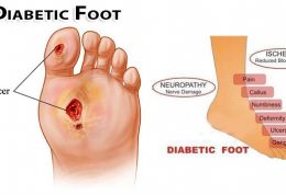 مزمن شدن زخم پای دیابتی ها
