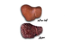 عوامل خوراکی تاثیرگذار بر بروز سیروز کبدی