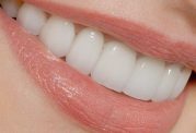 بدون پزشک دندان تان را با خمیر پر کننده پر کنید