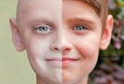حقایقی دردناک درباره کودکان سرطانی