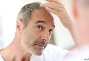موثر ترین روش ها برای جلوگیری از ریزش مو در مردان