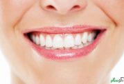 افزایش سفیدی دندان