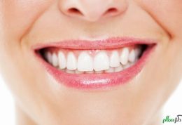 افزایش سفیدی دندان