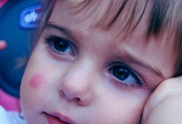 محصولات بهداشتی خطرساز برای پوست کودکان