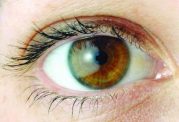 3 بیماری چشم+راه درمان