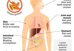 باید و نباید های تغذیه ای مبتلایان به عارضه سلیاک