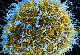 آیا در مورد ویروس مهلک و مرگبار ابولا اطلاعات دارید؟