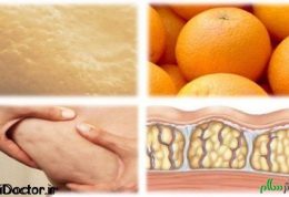 مواد غذایی مفید برای از بین بردن سلولیت