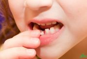 مقابله با از دست دادن ناگهانی دندان