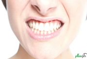 دندان قروچه چیست و راه های درمان آن کدامند؟