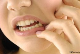 مهمترین راهکار پیشگیری از پوسیدگی دندان‌ها