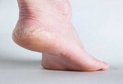 آیا زانو درد و کمر درد با کف پا ارتباطی دارند؟